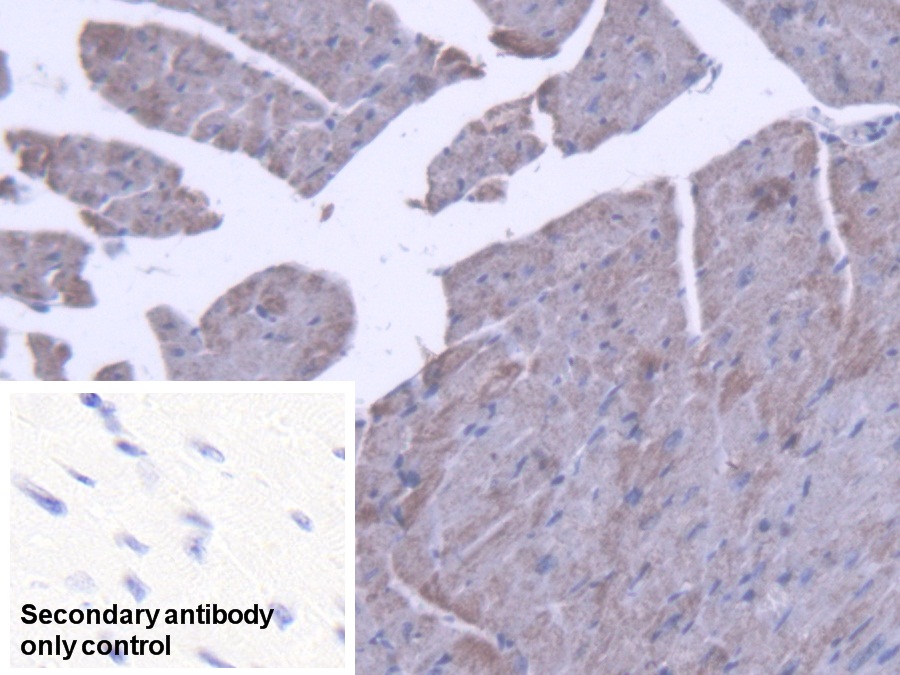 Polyclonal Antibody to Acyl Coenzyme A Dehydrogenase, C2-To-C3 Short Chain (ACADS)