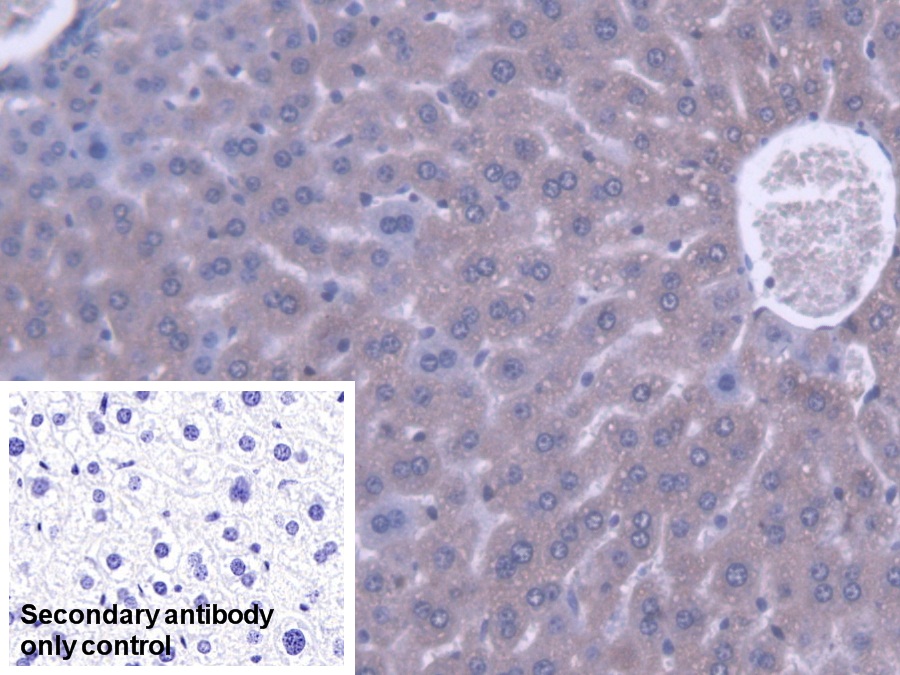 Polyclonal Antibody to Acyl Coenzyme A Dehydrogenase, C2-To-C3 Short Chain (ACADS)