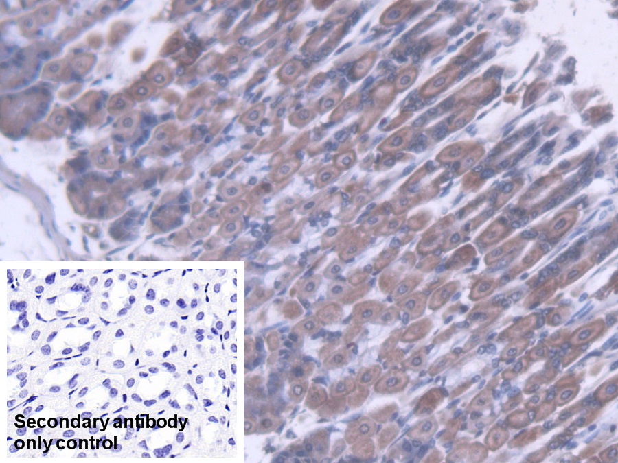 Polyclonal Antibody to Acyl Coenzyme A Dehydrogenase, C2-To-C3 Short Chain (ACADS)