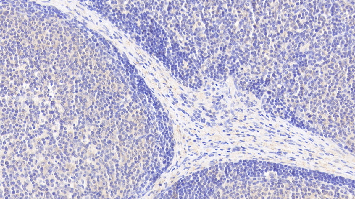 Polyclonal Antibody to Acetyl Coenzyme A Acetyltransferase 1 (ACAT1)