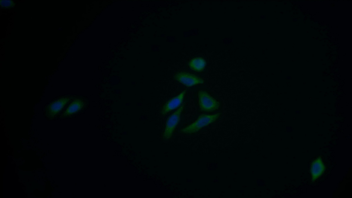 Polyclonal Antibody to Acetyl Coenzyme A Acetyltransferase 1 (ACAT1)