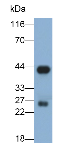 Polyclonal Antibody to Acetyl Coenzyme A Acetyltransferase 1 (ACAT1)