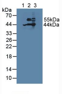 Polyclonal Antibody to Acetyl Coenzyme A Acetyltransferase 2 (ACAT2)