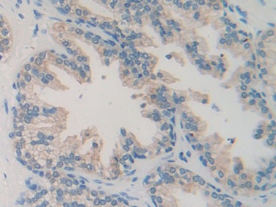 Polyclonal Antibody to Acetyl Coenzyme A Acetyltransferase 2 (ACAT2)