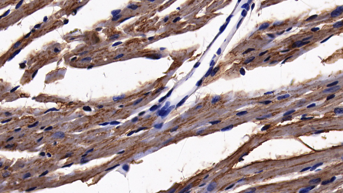 Polyclonal Antibody to Acyl Coenzyme A Synthetase Long Chain Family, Member 1 (ACSL1)