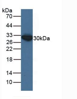 Polyclonal Antibody to Enoyl Coenzyme A Hydratase 1, Peroxisomal (ECH1)