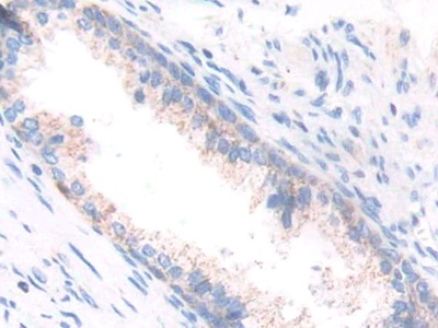 Polyclonal Antibody to Enoyl Coenzyme A Hydratase 1, Peroxisomal (ECH1)