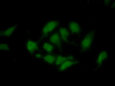 Polyclonal Antibody to Enoyl Coenzyme A Hydratase 1, Peroxisomal (ECH1)