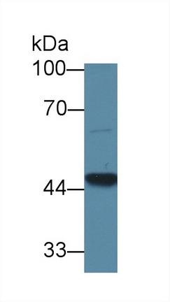 Polyclonal Antibody to Glutaryl Coenzyme A Dehydrogenase (GCDH)