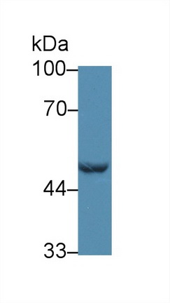 Polyclonal Antibody to Glutaryl Coenzyme A Dehydrogenase (GCDH)