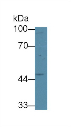 Polyclonal Antibody to Glutaryl Coenzyme A Dehydrogenase (GCDH)