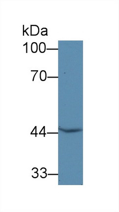 Polyclonal Antibody to Glutaryl Coenzyme A Dehydrogenase (GCDH)