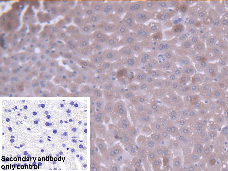 Polyclonal Antibody to Glutaryl Coenzyme A Dehydrogenase (GCDH)