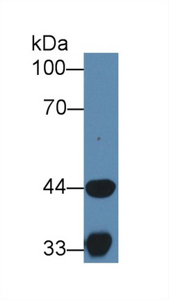 Polyclonal Antibody to Hydroxyacyl Coenzyme A Dehydrogenase (HADH)