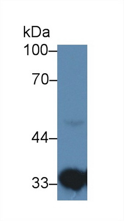 Polyclonal Antibody to Hydroxyacyl Coenzyme A Dehydrogenase (HADH)