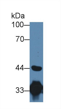 Polyclonal Antibody to Hydroxyacyl Coenzyme A Dehydrogenase (HADH)