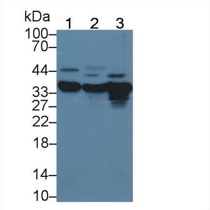 Polyclonal Antibody to Hydroxyacyl Coenzyme A Dehydrogenase (HADH)