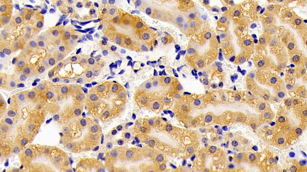 Polyclonal Antibody to Hydroxyacyl Coenzyme A Dehydrogenase (HADH)