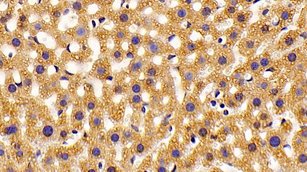 Polyclonal Antibody to Hydroxyacyl Coenzyme A Dehydrogenase (HADH)