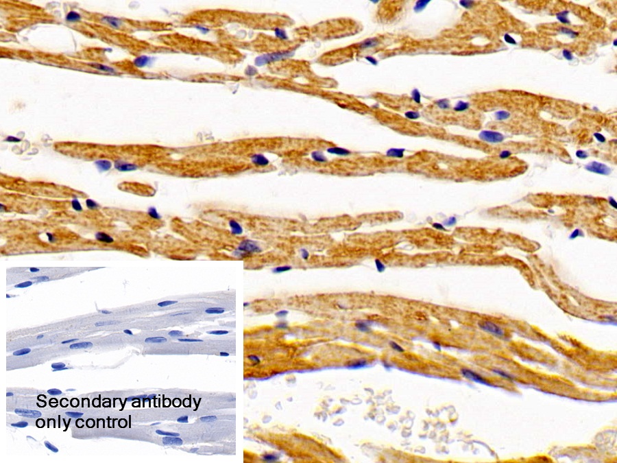 Polyclonal Antibody to Hydroxyacyl Coenzyme A Dehydrogenase (HADH)