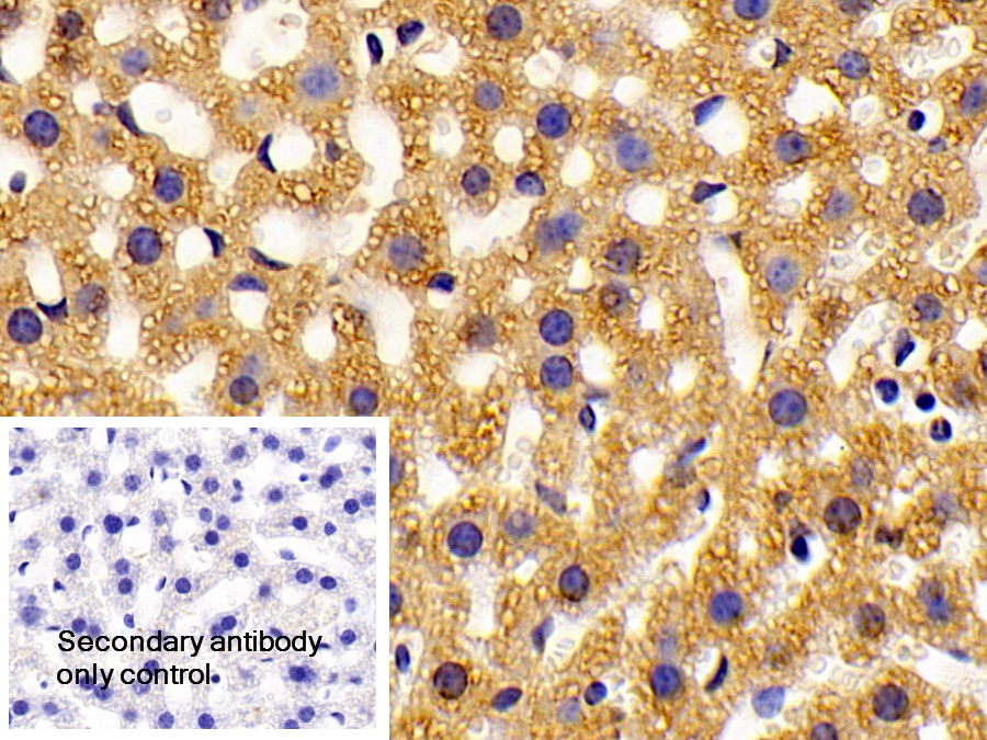 Polyclonal Antibody to Hydroxyacyl Coenzyme A Dehydrogenase (HADH)