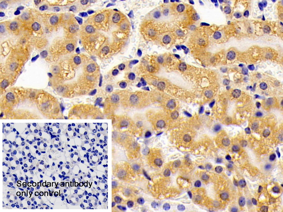 Polyclonal Antibody to Hydroxyacyl Coenzyme A Dehydrogenase (HADH)