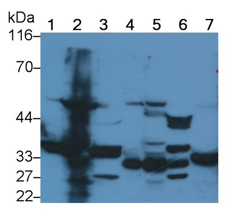 Polyclonal Antibody to 3-Hydroxymethyl-3-Methylglutaryl Coenzyme A Lyase (HMGCL)