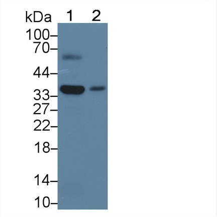 Polyclonal Antibody to 3-Hydroxymethyl-3-Methylglutaryl Coenzyme A Lyase (HMGCL)