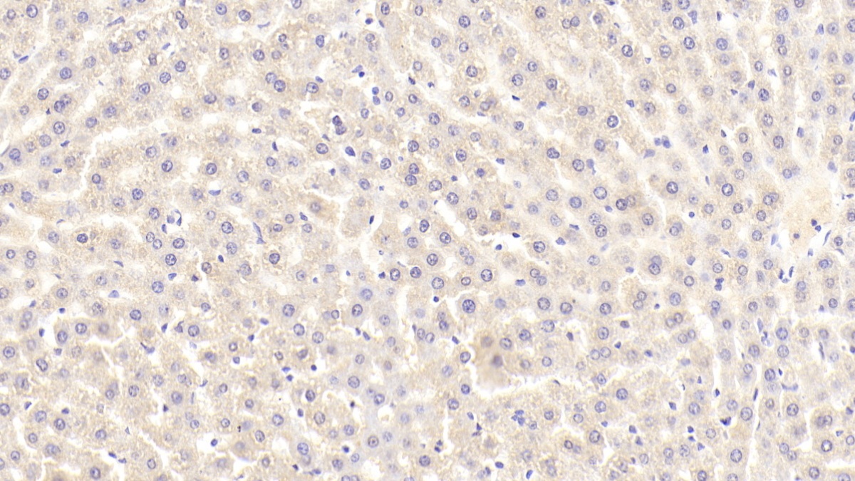 Polyclonal Antibody to 3-Hydroxy-3-Methylglutaryl Coenzyme A Reductase (HMGCR)