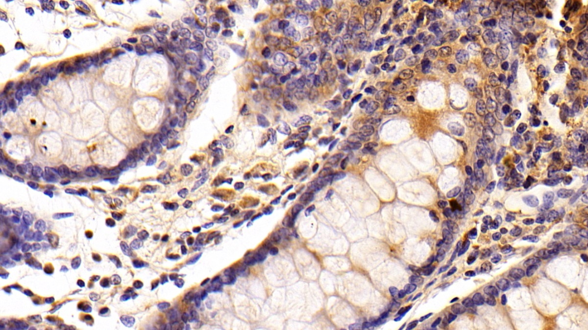 Polyclonal Antibody to 3-Hydroxy-3-Methylglutaryl Coenzyme A Reductase (HMGCR)