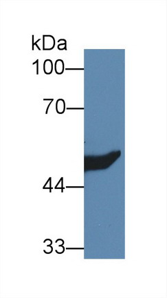 Polyclonal Antibody to Hydroxymethylglutaryl Coenzyme A Synthase 2, Mitochondrial (HMGCS2)