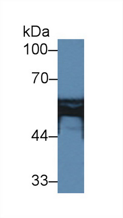 Polyclonal Antibody to Hydroxymethylglutaryl Coenzyme A Synthase 2, Mitochondrial (HMGCS2)