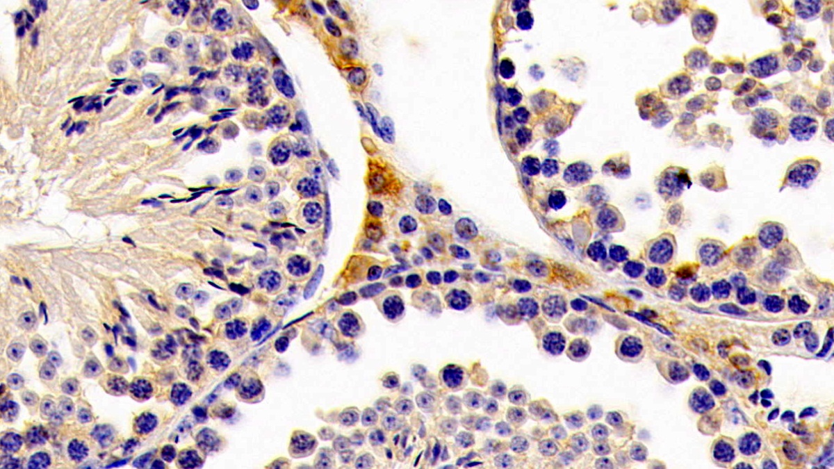 Polyclonal Antibody to Hydroxymethylglutaryl Coenzyme A Synthase 2, Mitochondrial (HMGCS2)