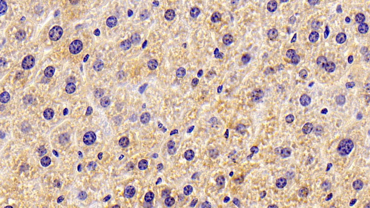 Polyclonal Antibody to Hydroxymethylglutaryl Coenzyme A Synthase 2, Mitochondrial (HMGCS2)