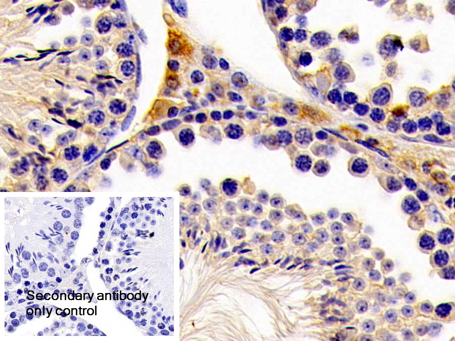 Polyclonal Antibody to Hydroxymethylglutaryl Coenzyme A Synthase 2, Mitochondrial (HMGCS2)