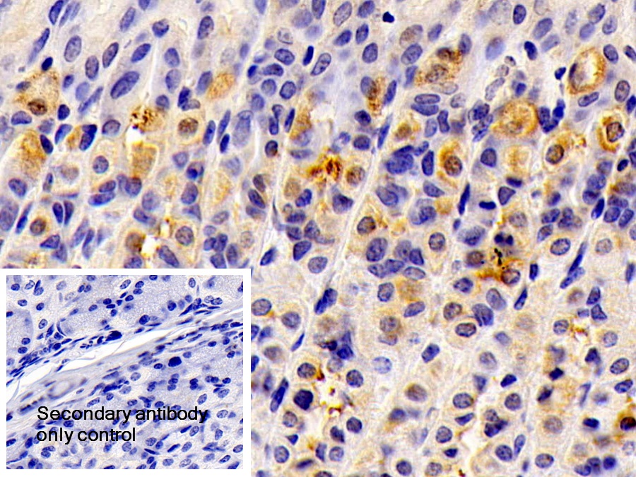 Polyclonal Antibody to Hydroxymethylglutaryl Coenzyme A Synthase 2, Mitochondrial (HMGCS2)