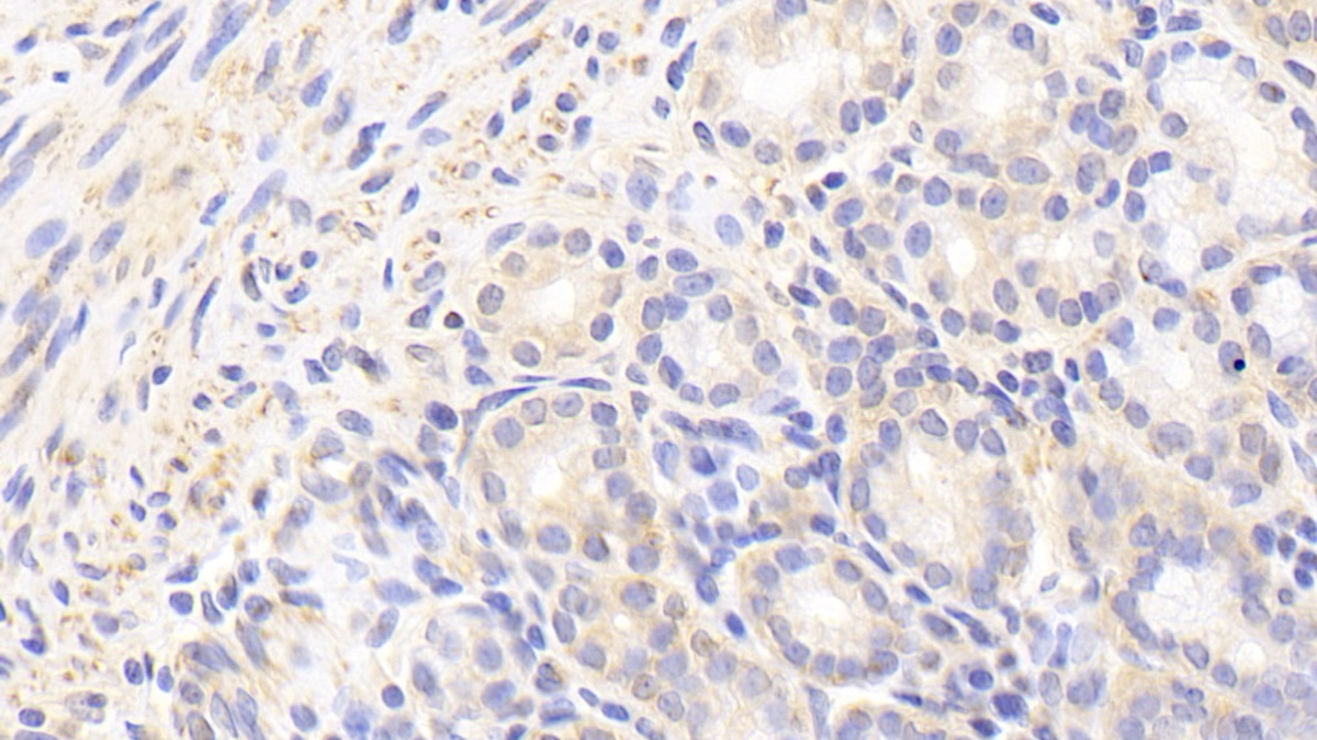 Polyclonal Antibody to Methylcrotonoyl Coenzyme A Carboxylase 2 (MCCC2)