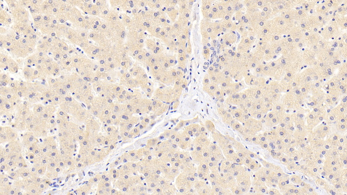 Polyclonal Antibody to Methylcrotonoyl Coenzyme A Carboxylase 2 (MCCC2)