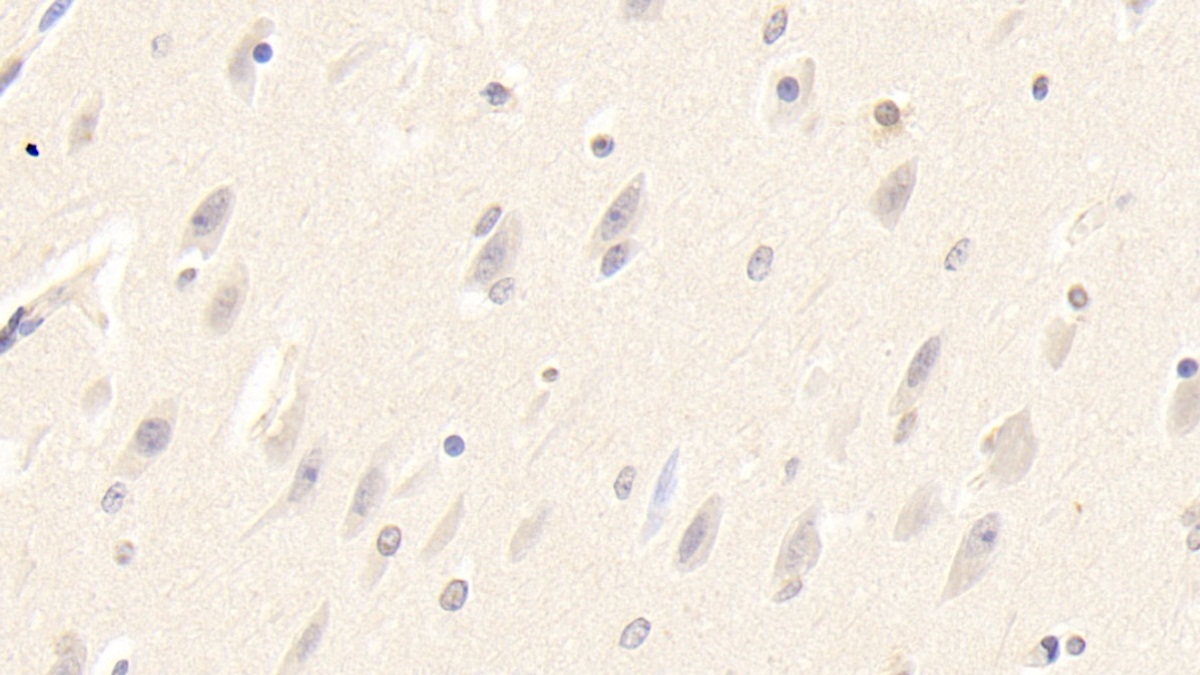 Polyclonal Antibody to Methylcrotonoyl Coenzyme A Carboxylase 2 (MCCC2)