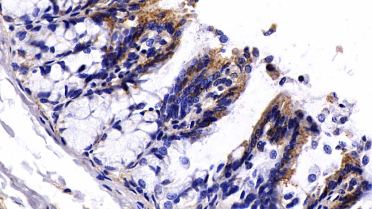 Polyclonal Antibody to Propionyl Coenzyme A Carboxylase Alpha (PCCa)