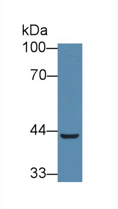 Polyclonal Antibody to Peroxisomal D3, D2-Enoyl Coenzyme A Isomerase (PECI)