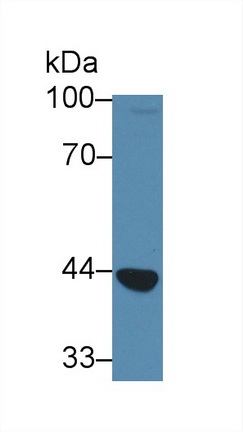 Polyclonal Antibody to Peroxisomal D3, D2-Enoyl Coenzyme A Isomerase (PECI)