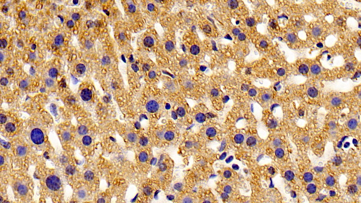 Polyclonal Antibody to Peroxisomal D3, D2-Enoyl Coenzyme A Isomerase (PECI)