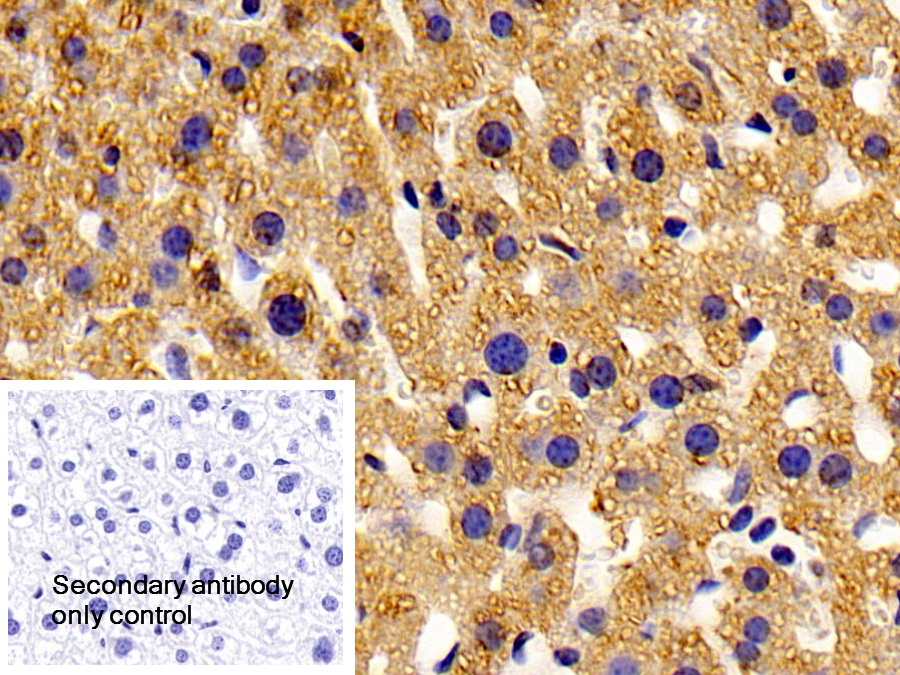 Polyclonal Antibody to Peroxisomal D3, D2-Enoyl Coenzyme A Isomerase (PECI)