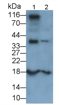 Polyclonal Antibody to Diazepam Binding Inhibitor (DBI)