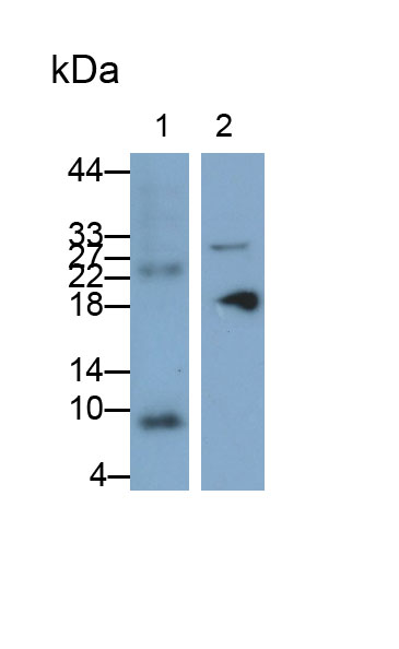 Polyclonal Antibody to Diazepam Binding Inhibitor (DBI)