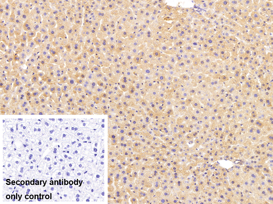 Polyclonal Antibody to Diazepam Binding Inhibitor (DBI)