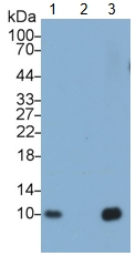 Polyclonal Antibody to Diazepam Binding Inhibitor (DBI)