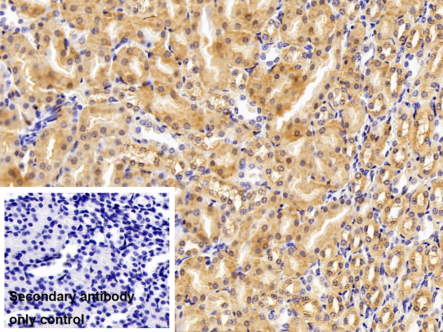 Polyclonal Antibody to Diazepam Binding Inhibitor (DBI)