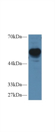 Polyclonal Antibody to Regulator Of G Protein Signaling 7 (RGS7)